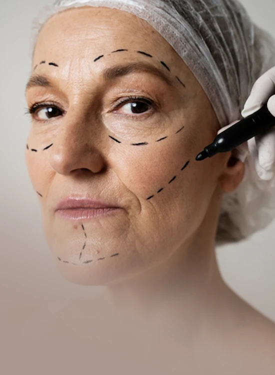 SCULPTRA.jpg.webp